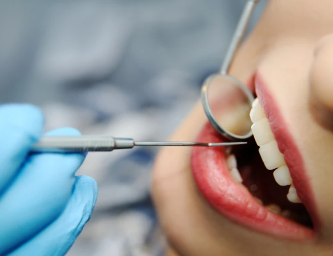 Zákoutí dentální hygieny