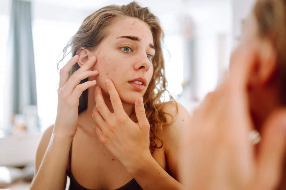 K-beauty a akné: Korejské tajemství čisté pleti hlavní banner
